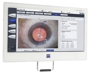 蔡司CALLISTO eye数字导航系统